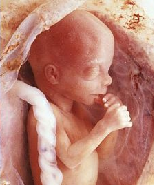 U2 losing fans after coming out in support of abortion