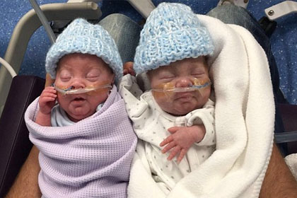 Twins who were born at the 24-week abortion limit defy the odds to become thriving toddlers