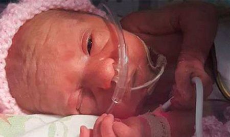 Premature baby given 2% chance of survival defies the odds