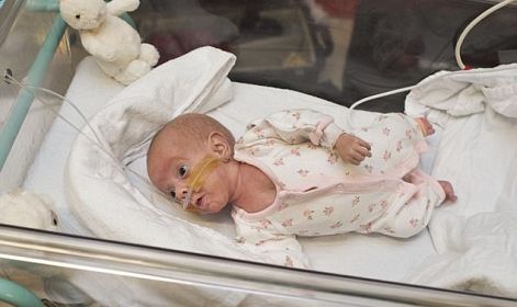 Baby girl born just one week after UK abortion limit survives against all odds