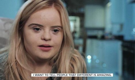 Teen model with Down's syndrome says ‘You can do anything’