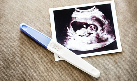 Press Release: Nearly 1 in 4 babies conceived aborted in 2018 - Horrifying new British Statistics must serve as a